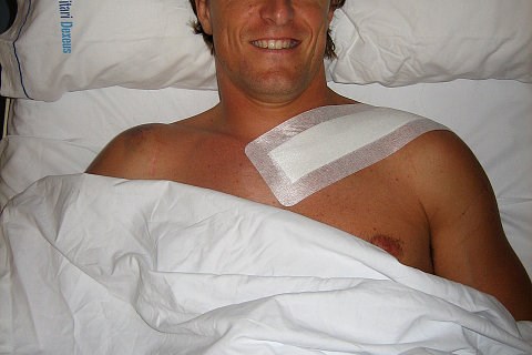 Gibernau legt sich unters Messer: Eine Platte entfernen