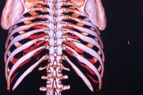 Capirossi doch mit Rippenbrüchen: De Puniet will Ruder in Mugello herumreißen