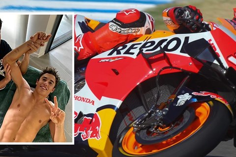 Marc Marquez musste ein zweites Mal operiert werden