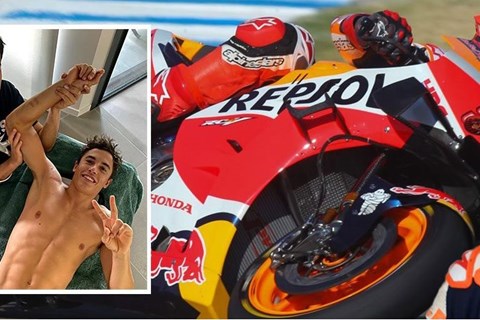 Marc Marquez's Albtraum: Infektion im Oberarm bestätigt Marc Marquez's Albtraum: Infektion im Oberarm bestätigt