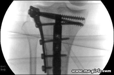 Sabine Doppelhofer fliegt wieder!